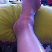 one little insect can cause a lot of problems