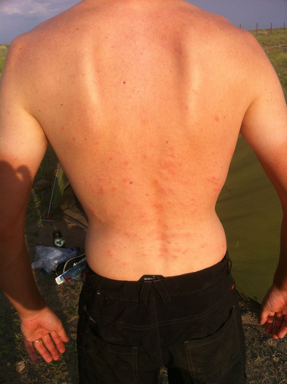 I got munched by mosquitos through my shirt!